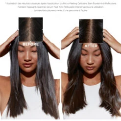 Sérum Cellulaire Nuit Anti-pelliculaire Intensif Symbiose Kérastase 90ML -Hair Care Soldes serum cellulaire nuit anti pelliculaire intensif symbiose kerastase 90ml 3