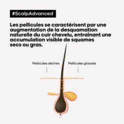Shampooing Clarifiant Antipelliculaire Scalp Advanced L'Oréal Professionnel 500ML -Hair Care Soldes shampooing clarifiant antipelliculaire scalp advanced l oreal professionnel 500ml 4